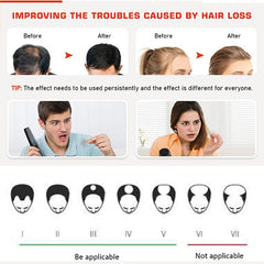 Hair Growth System Red Light Therapy Hair Loss Treatment Hair Care Cap