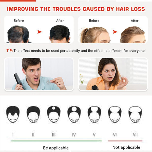 Hair Growth System Red Light Therapy Hair Loss Treatment Hair Care Cap